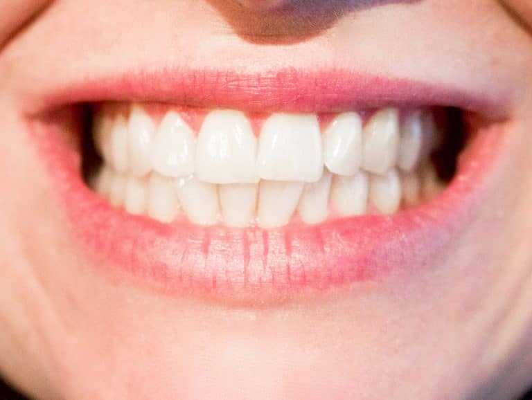Pourquoi y recourir et comment se déroule le traitement endodontique ?